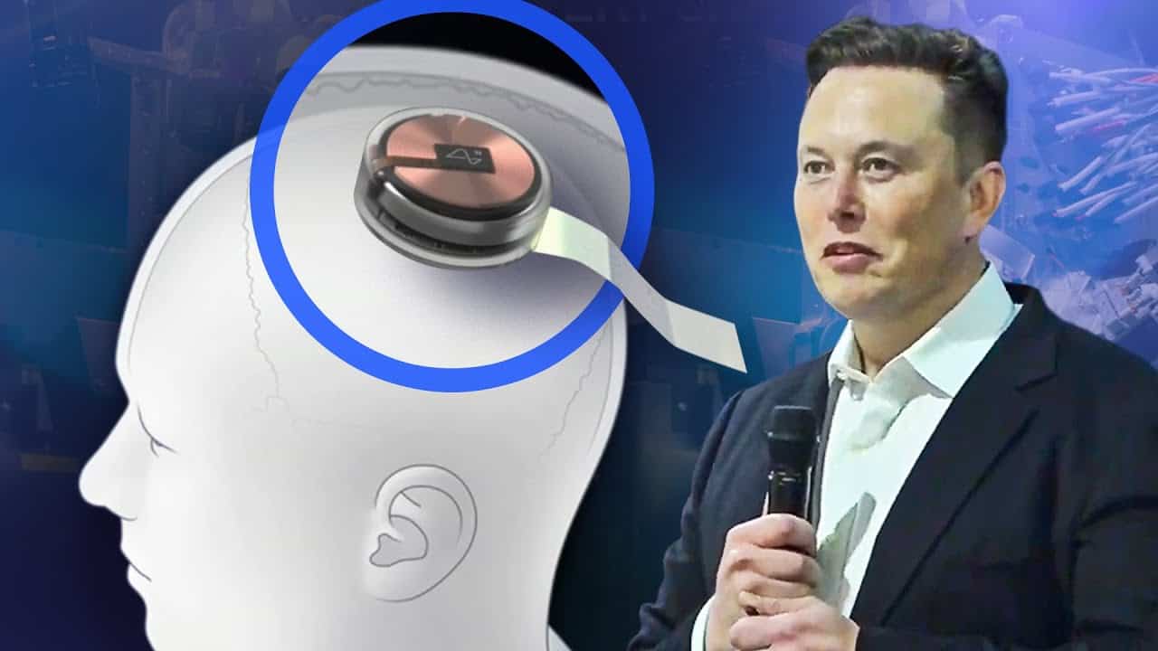 Telepathic Brain Chip to be implanted in a human by Elon Musk’s Neuralink Technology