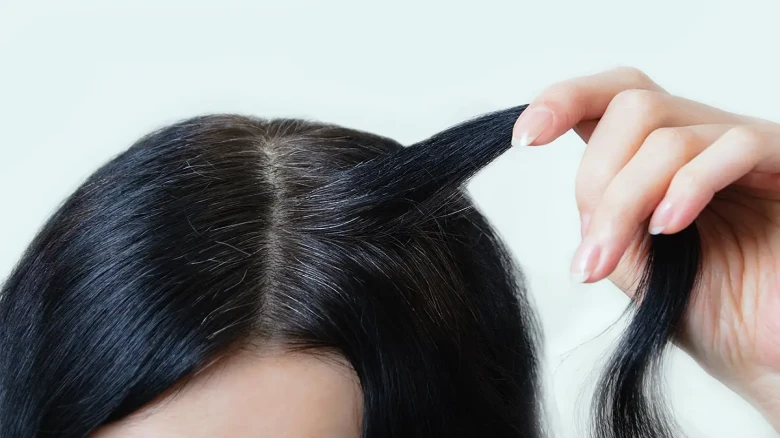 Tensed of Premature Grey Hair? Try these 5 home remedies