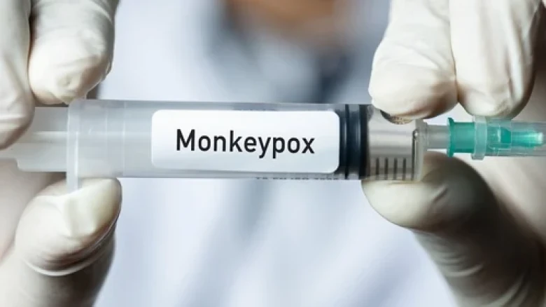 Monkeypox Does Not Spread Through Airborne Transmission: CDC
