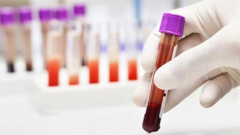 Blood Test that can detect Breast Cancer is available in India now