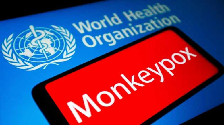 As cases of monkeypox increase globally, the Center's advice to states