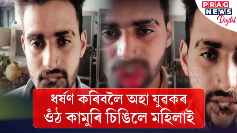 ধৰ্ষণৰ চেষ্টা! দাঁতেৰে জোৰেৰে কামুৰি যুৱকৰ ওঁঠ চিঙি দিলে সাহসী মহিলাই