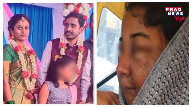 মেকআপ লগোৱাৰ পাছতে গৰম ভাপত ফুলি উঠিল কইনাৰ মুখ! ভাঙিল বিয়া! মেকআপ আৰ্টিষ্টৰ বিৰুদ্ধে আৰক্ষীৰ কাষ চাপিল পৰিয়াল, ক’ত?