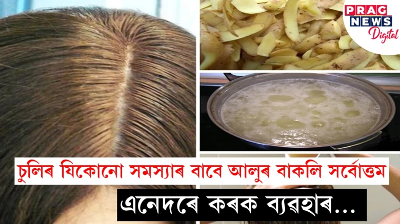 চুলিৰ যিকোনো সমস্যাৰ বাবে আলুৰ বাকলি সৰ্বোত্তম,  এনেদৰে কৰক ব্যৱহাৰ…