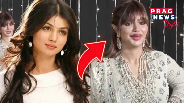 নাক-ওঁঠ কাটি ধুনীয়া হৈ পৰা বলীউডৰ পাঁচগৰাকী সুন্দৰী অভিনেত্ৰী