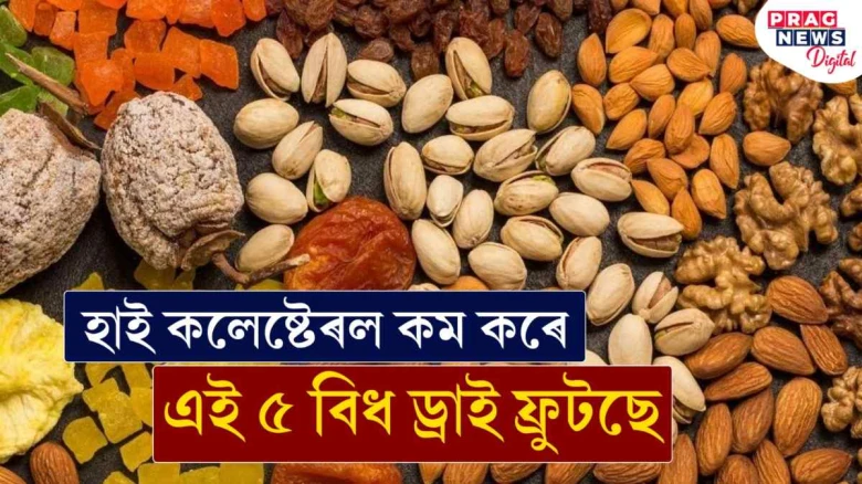 তিয়াই খাওক এই ৫বিধ ড্ৰাই ফ্ৰুটছ! ঔষধ নোখোৱাকৈ কমি যাব হাই কলেষ্টেৰল