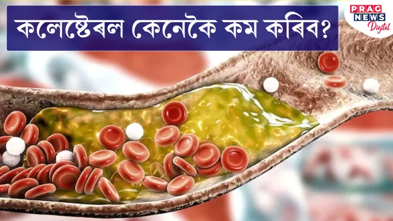 এই ৪টা বস্তুৱে কলেষ্টেৰল নিয়ন্ত্ৰণ কৰাত সহায় কৰে! জানি লওক কি কি?
