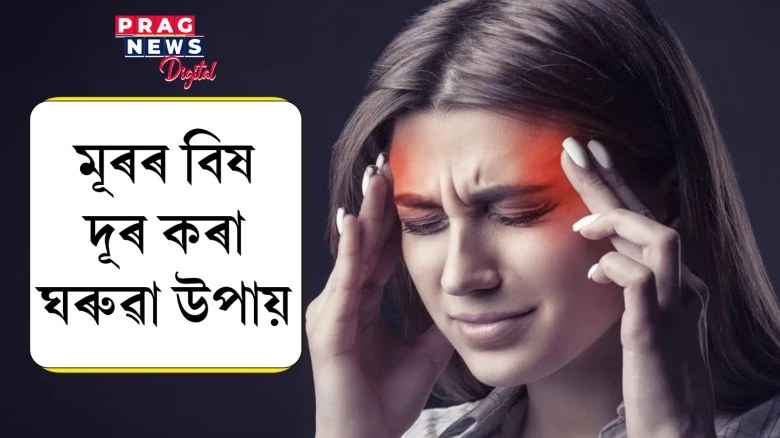 মূৰৰ বিষ হ’লে পেইন কিলাৰ নাখাব!  এই ঘৰুৱা উপায় গ্ৰহণ কৰক