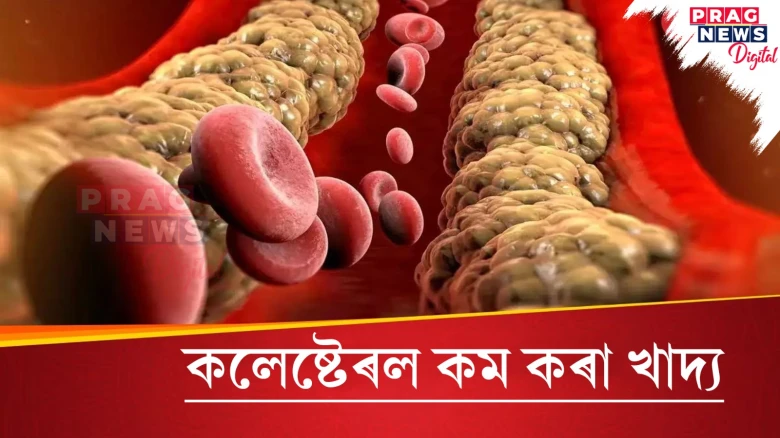 কলেষ্টেৰল বৃদ্ধি পাইছে? এইবোৰ বস্তু আপোনাৰ খাদ্যতালিকাত ৰাখক..সুফল পাব