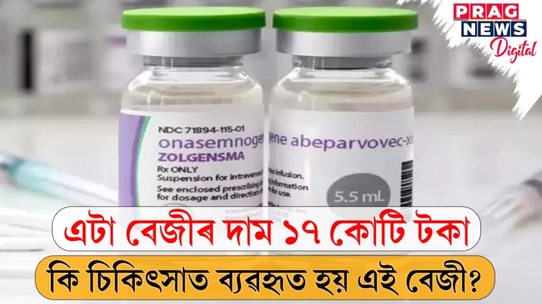 এপালি দৰৱৰ দাম ১৭ কোটি টকা; কিয় ব্যয়বহুল এছ এম এ ৰোগৰ চিকিৎসা? জানক সবিশেষ