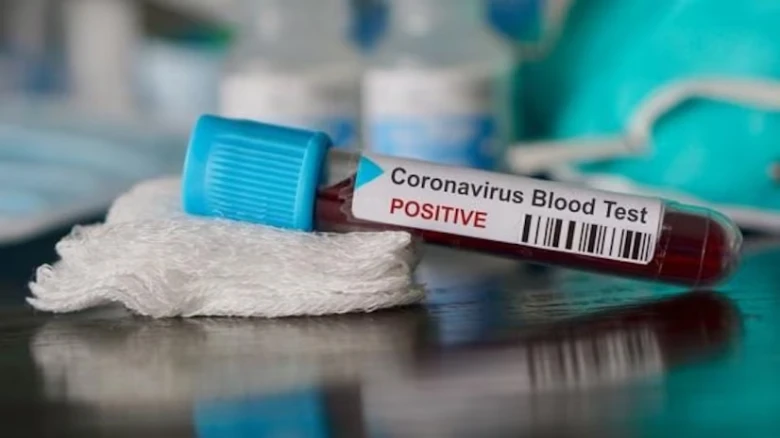 One COVID-19 Case Reported In Guwahati
