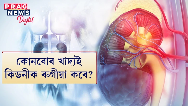 কোনবোৰ খাদ্যই কিডনীক ৰুগীয়া কৰে? বিতংককৈ জানি লওক