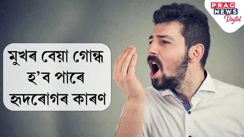 মুখৰ গোন্ধক নকৰিব অৱহেলা, হৃদৰোগৰ লক্ষণো হ’ব পাৰে! জানক সবিশেষ
