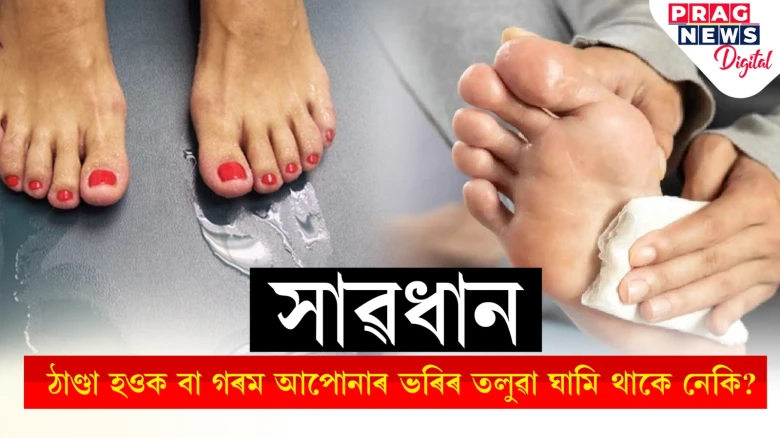 ঠাণ্ডা হওক বা গৰম আপোনাৰ ভৰিৰ তলুৱা ঘামি থাকে নেকি? হ’ব পাৰে গুৰুতৰ সমস্যা