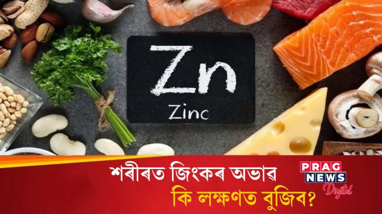 শৰীৰত জিংকৰ অভাৱ হ’লে এই লক্ষণসমূহে দেখা দিয়ে! আওকাণ কৰিলে হ’ব ক্ষতি