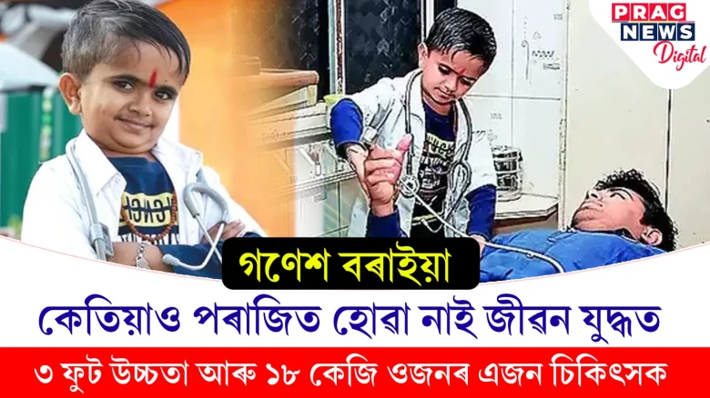 কেতিয়াও পৰাজিত হোৱা নাই জীৱন যুদ্ধত; ৩ ফুট উচ্চতা আৰু ১৮ কেজি ওজনৰ এজন চিকিৎসক