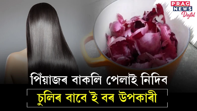 পিঁয়াজৰ বাকলি আজিৰেপৰা নেপেলাব! চুলিৰ বাবে ই এক যাদুকৰী সমাধান