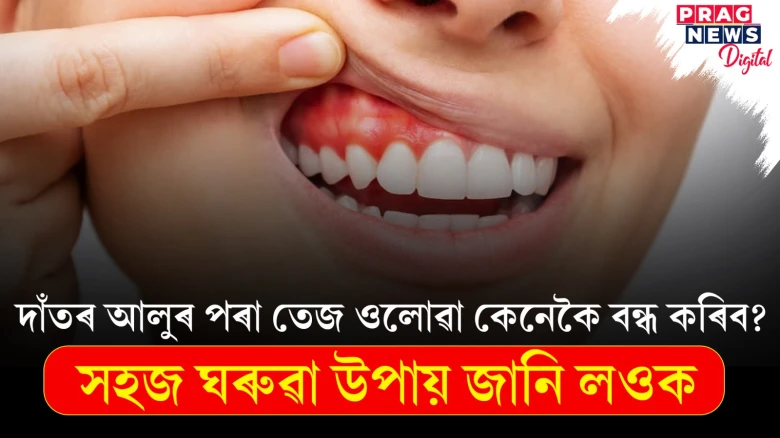 দাঁতৰ আলুৰ পৰা তেজ ওলালে কি কৰিব? ভাল কৰাৰ ঘৰুৱা উপায় জানি লওক