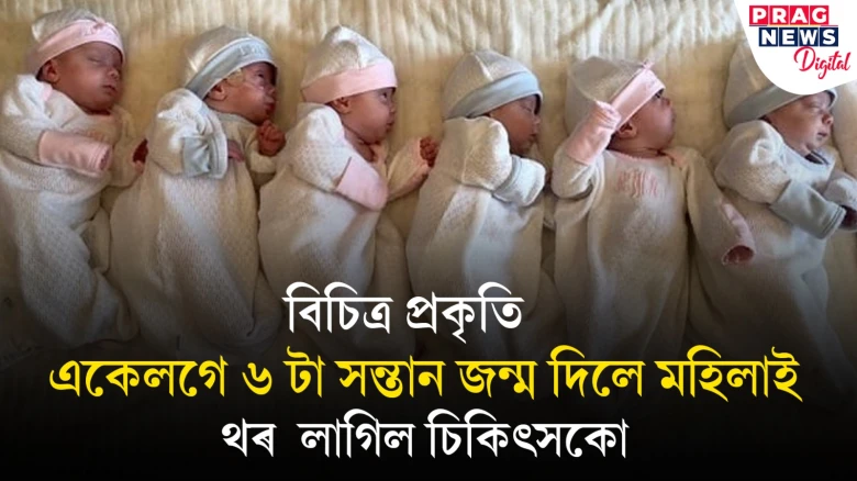 বিচিত্ৰ প্ৰকৃতিঃ একেলগে ৬ টা সন্তান জন্ম দিলে মহিলাই, থৰ  লাগিল চিকিৎসকো