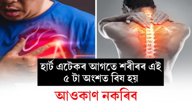 featured post