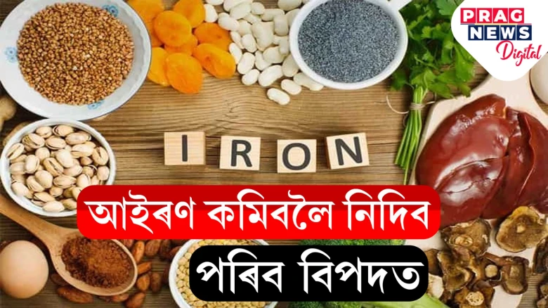 দেহত আইৰণ নাথাকিলে ৰক্তহীনতা হ'ব পাৰে!  আইৰণৰ অভাৱৰ লক্ষণ আৰু  কি কি খোৱাটো উচিত জানি লওক