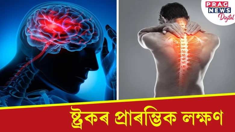 ষ্ট্ৰোকৰ ৫ টা সতৰ্কবাণী কি কি জানি লওক