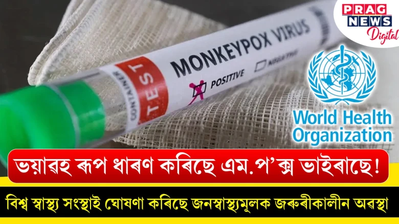 ভয়াৱহ ৰূপ ধাৰণ কৰিছে এম.প’ক্স ভাইৰাছে!  বিশ্ব স্বাস্থ্য সংস্থাই ঘোষণা কৰিছে জনস্বাস্থ্যমূলক জৰুৰীকালীন অৱস্থা