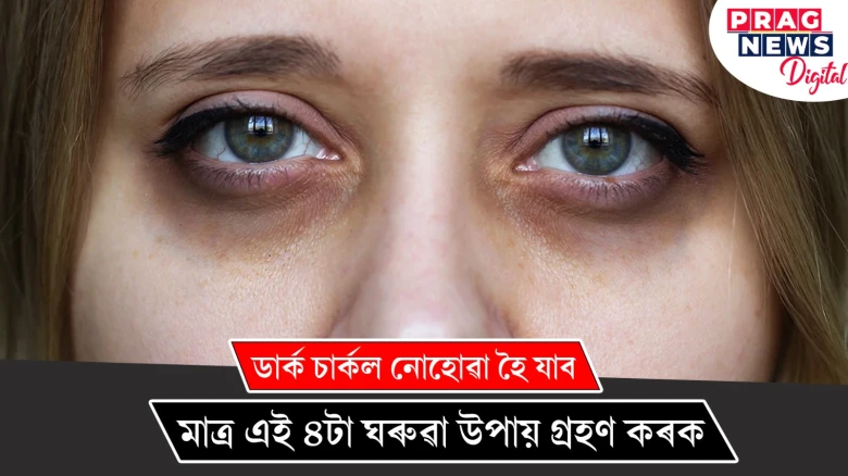 ডাৰ্ক চাৰ্কল আঁতৰাবলৈ মাত্ৰ এই ৪টা ঘৰুৱা উপায় গ্ৰহণ কৰক