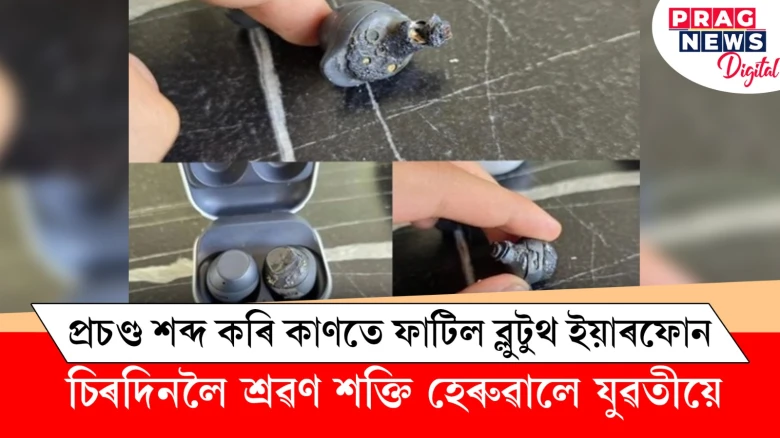 সাৱধান! যুৱতীৰ কাণত ব্লুটুথ ইয়াৰফোনৰ বিস্ফোৰণ; হেৰুৱালে শ্ৰৱণ শক্তি