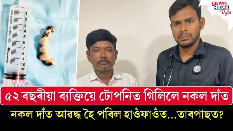 এজন লোকে টোপনিতে গিলিলে নিজৰ এপাৰি কৃত্ৰিম দাঁত! তাৰপাছত?