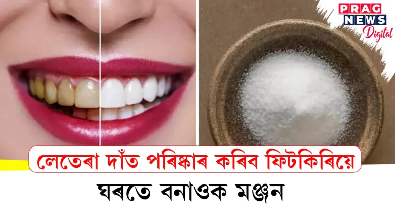 featured post