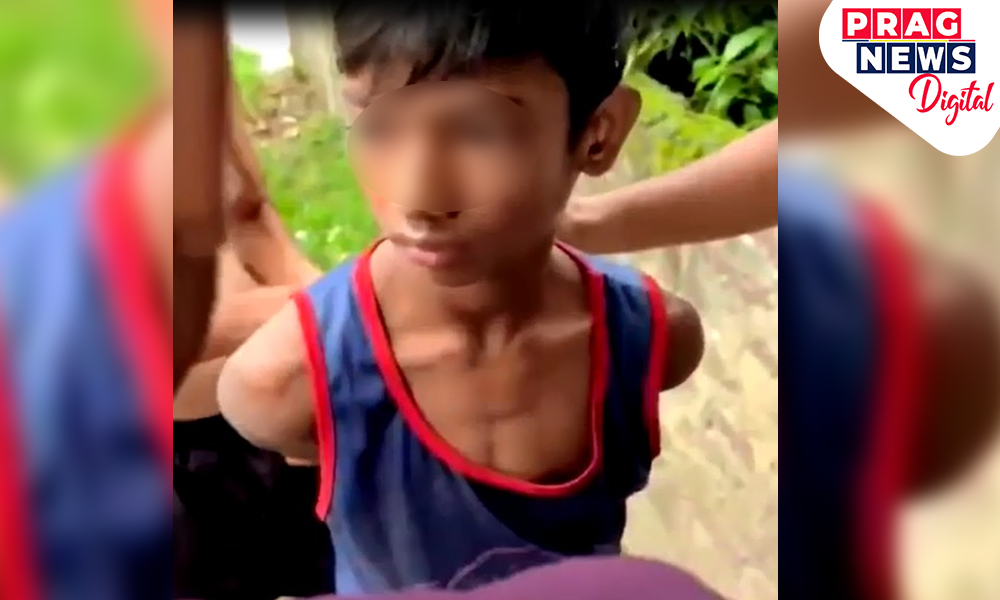 12-Year-Old Boy Endures Brutal Torture Over Theft Allegations