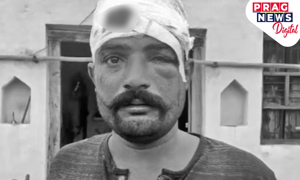 জোঁৱাইক ২৫ ছেকেণ্ডত ৩৫ টাতকৈ অধিক ঘোচা  মাৰিলে শহুৰৰ পৰিয়ালে! চিচিটিভিত বন্দী নৃশংসতা