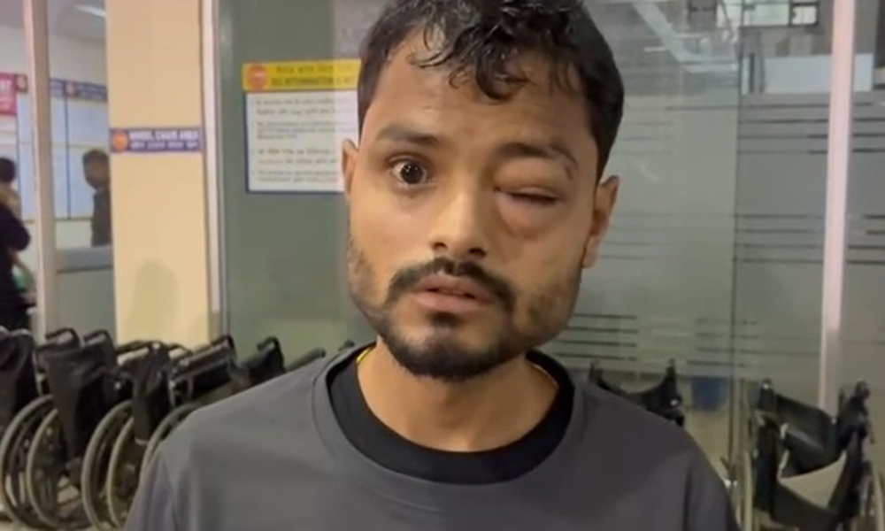 Guwahati: Youth Brutally Assaulted Inside Central Mall, FIR Filed Against Staff Member