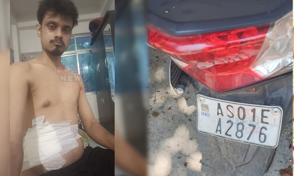 Chandmari Police Accused of Pressing Hot Silencer Against Youth's Stomach