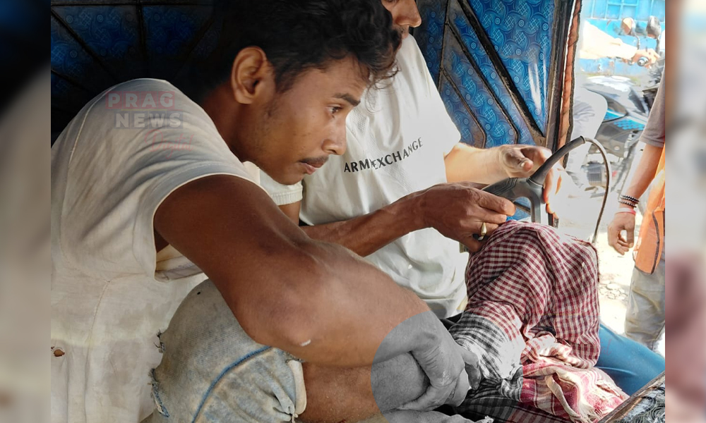 Worker Suffers Severe Injury as Foot Gets Trapped at Noonmati-Dighalipukhuri Flyover