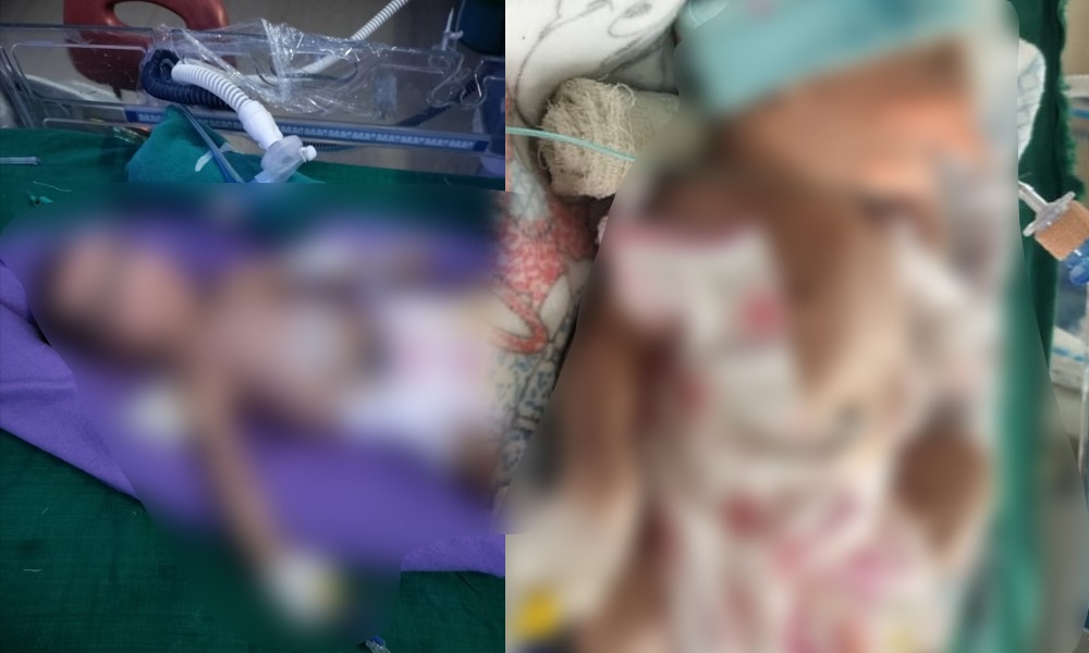 AMCHত ভয়ংকৰ ঘটনা! প্ৰসূতি বিভাগৰ ICUৰ পৰা নৱজাতক সলনিৰ গুৰুতৰ অভিযোগ