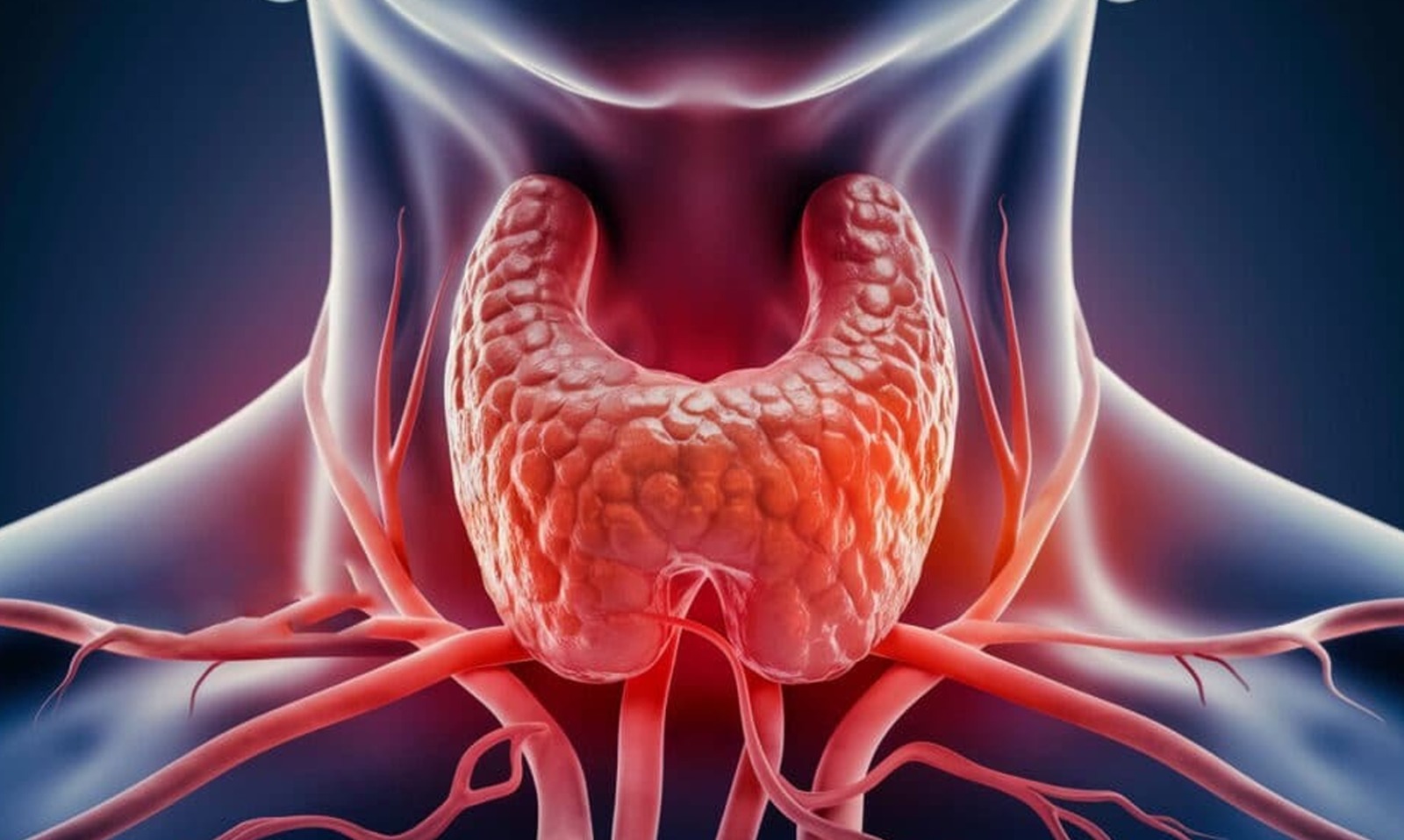 থাইৰয়ড ৰোগীয়ে কি কি খোৱাৰ পৰা বিৰত থাকিব লাগে? জানি লওক