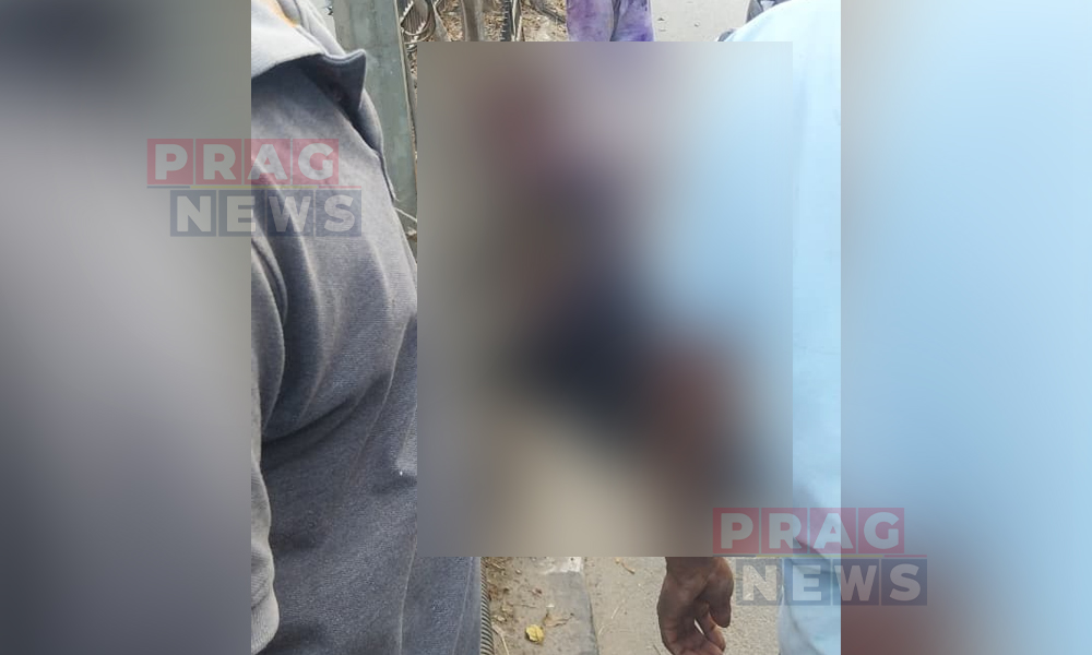 Youth Loses Life as Rod Pierces Face and Exits through Head in Mathgharia