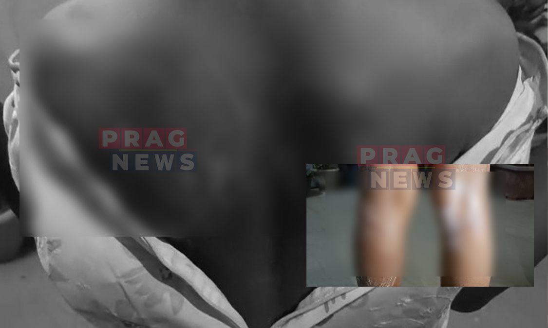 Teacher Arrested for Allegedly Beating 2nd Standard Student in Charaideo