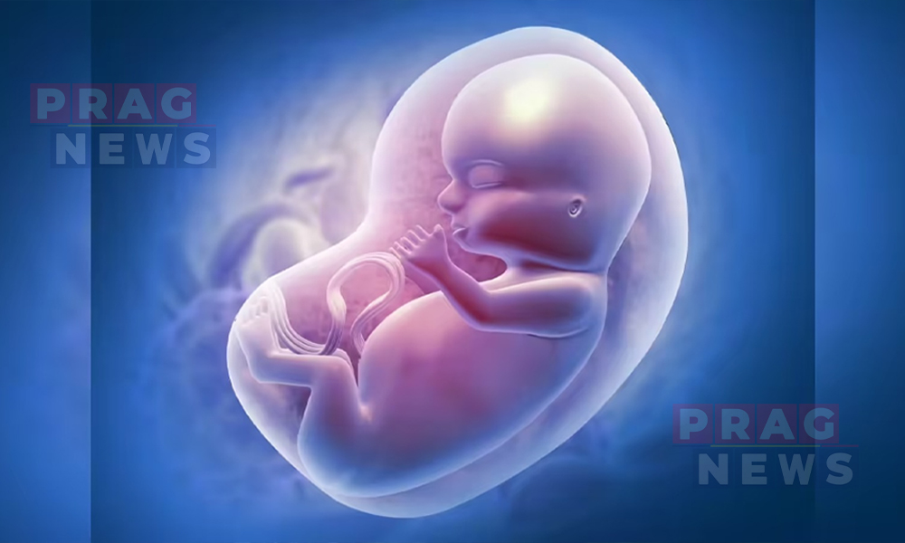 Unborn Baby Dies following Assault on Pregnant Woman by Group in Hajo