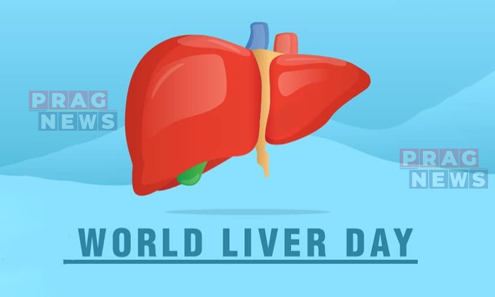 World Liver Day 2026: ‘Solid Habits, Strong Liver’ Campaign Urges Lifestyle Changes to Combat Silent Liver Diseases