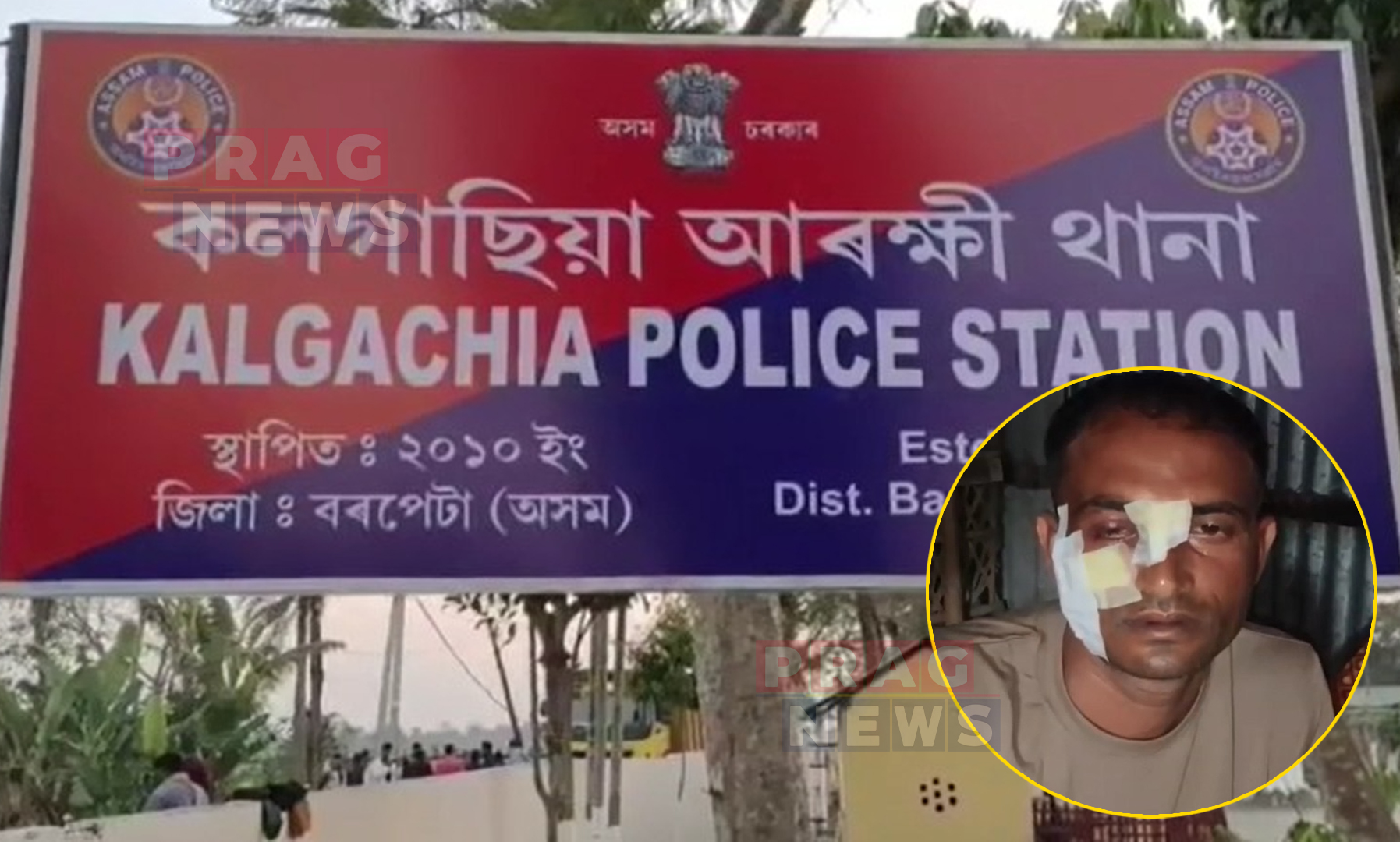Woman Allegedly Attempts to Murder Husband with Machete: Flees with Cash in Kalgachia