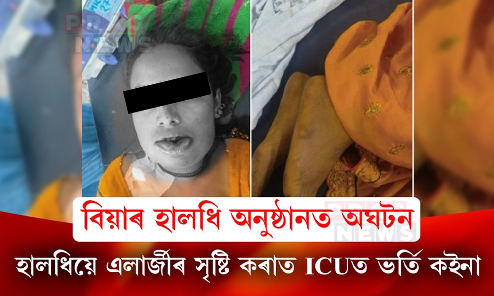 বিয়াৰ হালধি অনুষ্ঠানত হালধি লগাই ICUত ভৰ্তি কইনা