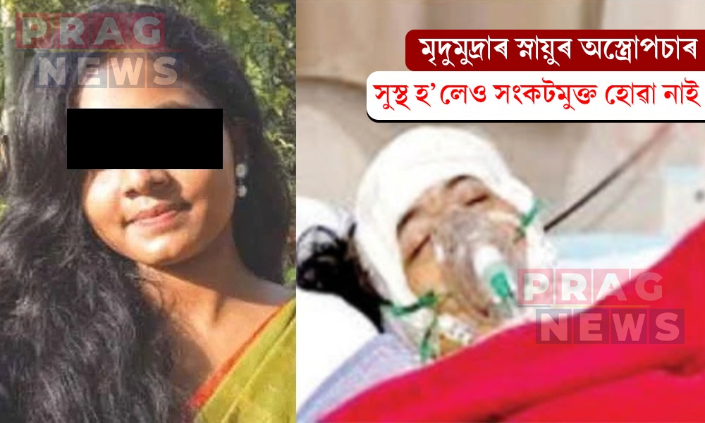 মৃদুমুদ্ৰাৰ স্নায়ুৰ অস্ত্রোপচাৰ; সুস্থ হ’লেও সংকটমুক্ত হোৱা নাই