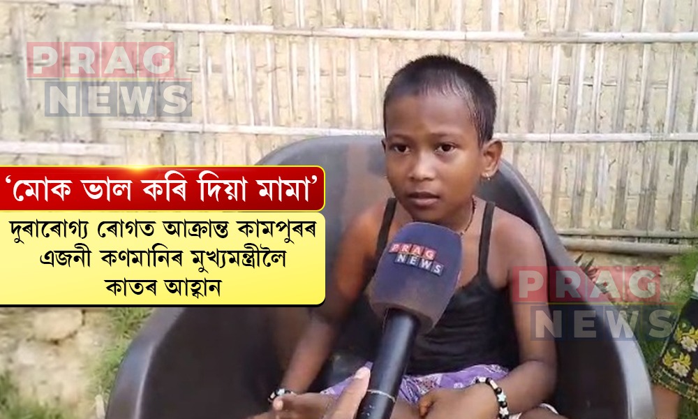 দুৰাৰোগ্য ৰোগত আক্ৰান্ত এজনী কণমানিয়ে সহায় বিচাৰি মুখ্যমন্ত্ৰীক জনাইছে কাতৰ আহ্বান