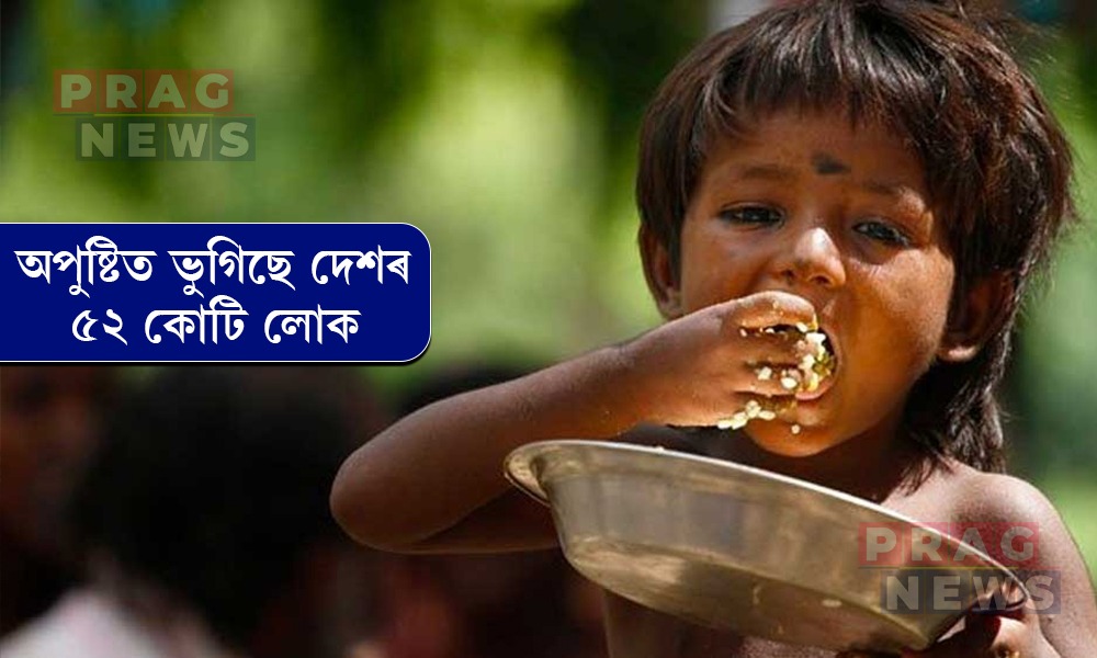 অপুষ্টিত ভুগিছে দেশৰ ৫২ কোটি লোক