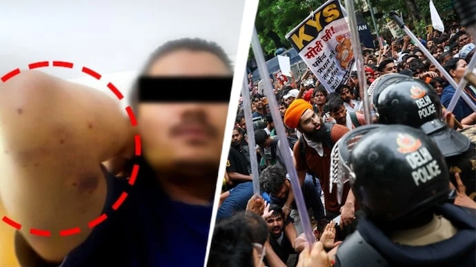 Inquiry Initiated After Pellet Rounds Fired at Protesters During Delhi Parliament March
