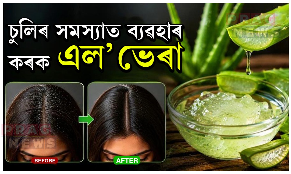চুলিৰ সমস্যা দূৰ কৰে এল’ভেৰাই; কেনেদৰে কৰিব ব্যৱহাৰ?