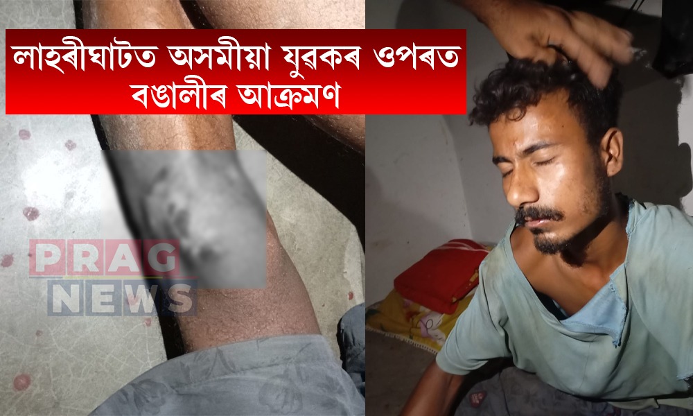 লাহৰীঘাটত চাঞ্চল্য! অসমীয়া যুৱকৰ ওপৰত বঙালীৰ আক্ৰমণ